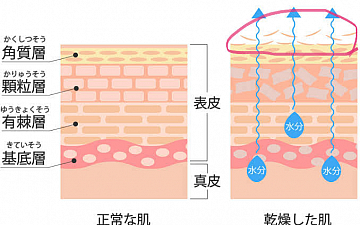 頭皮の保湿が大切な理由①