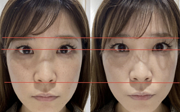 V3ファンデーション、ビフォーアフター