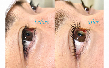 お客様劇的ビフォーアフター