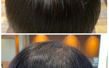 強髪プログラム 強くしなやかな髪は創れます